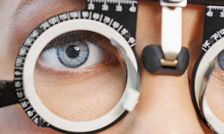 Top 5 Eye Exam Questions and Concerns