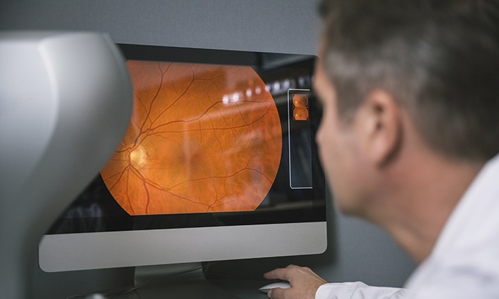 Health Risks Detected with An Eye Exam
